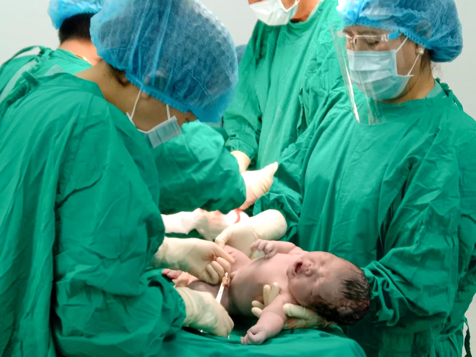 Neugeborenes nach Kaiserschnitt